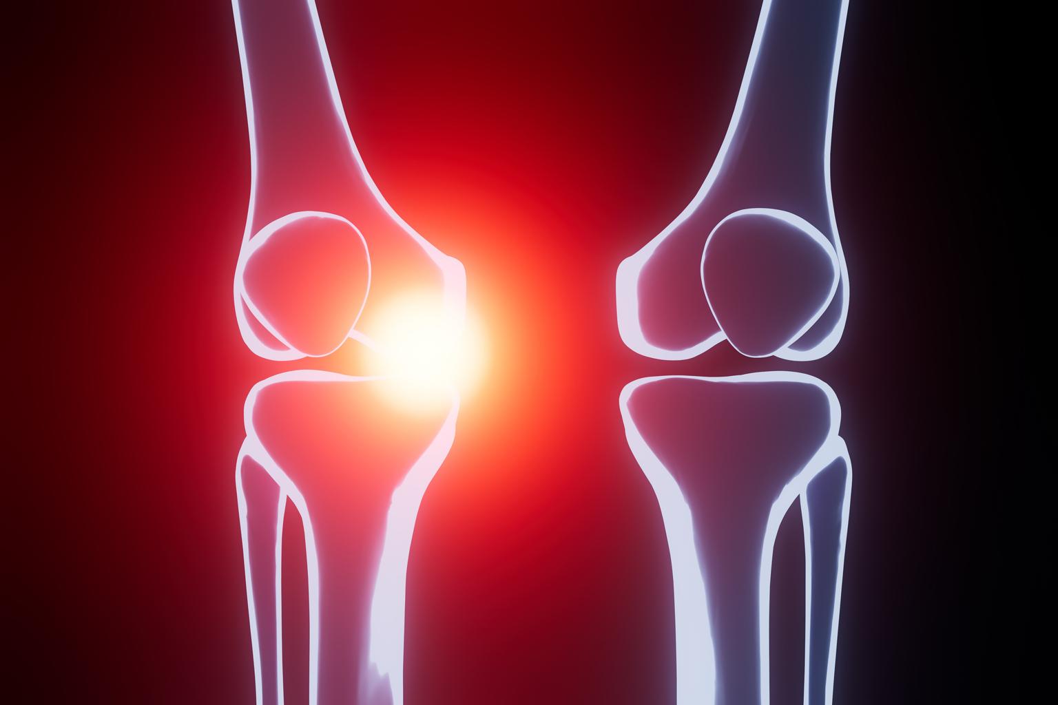 الوقاية من آلام الركبة